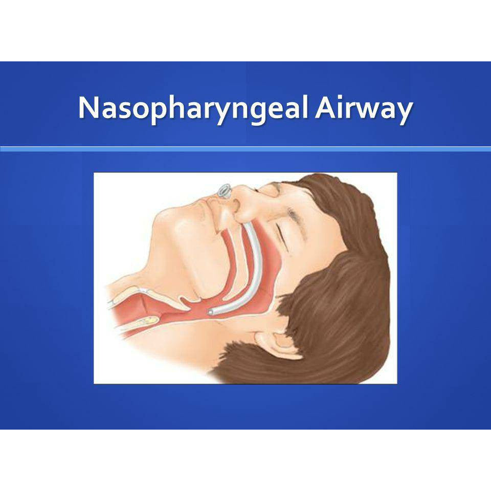 oropharyngeal airway and nasopharyngeal airway
